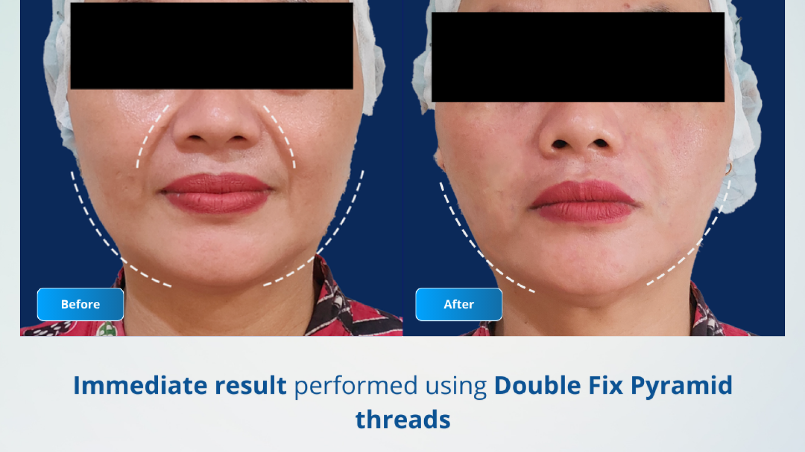 Before After - H0 28 November 2025