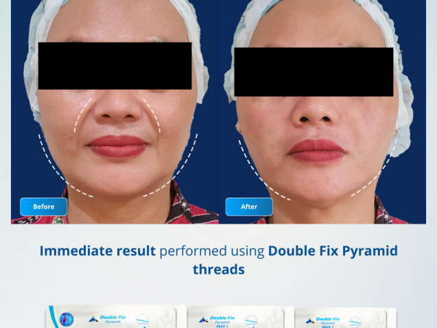 Before After - H0 28 November 2025