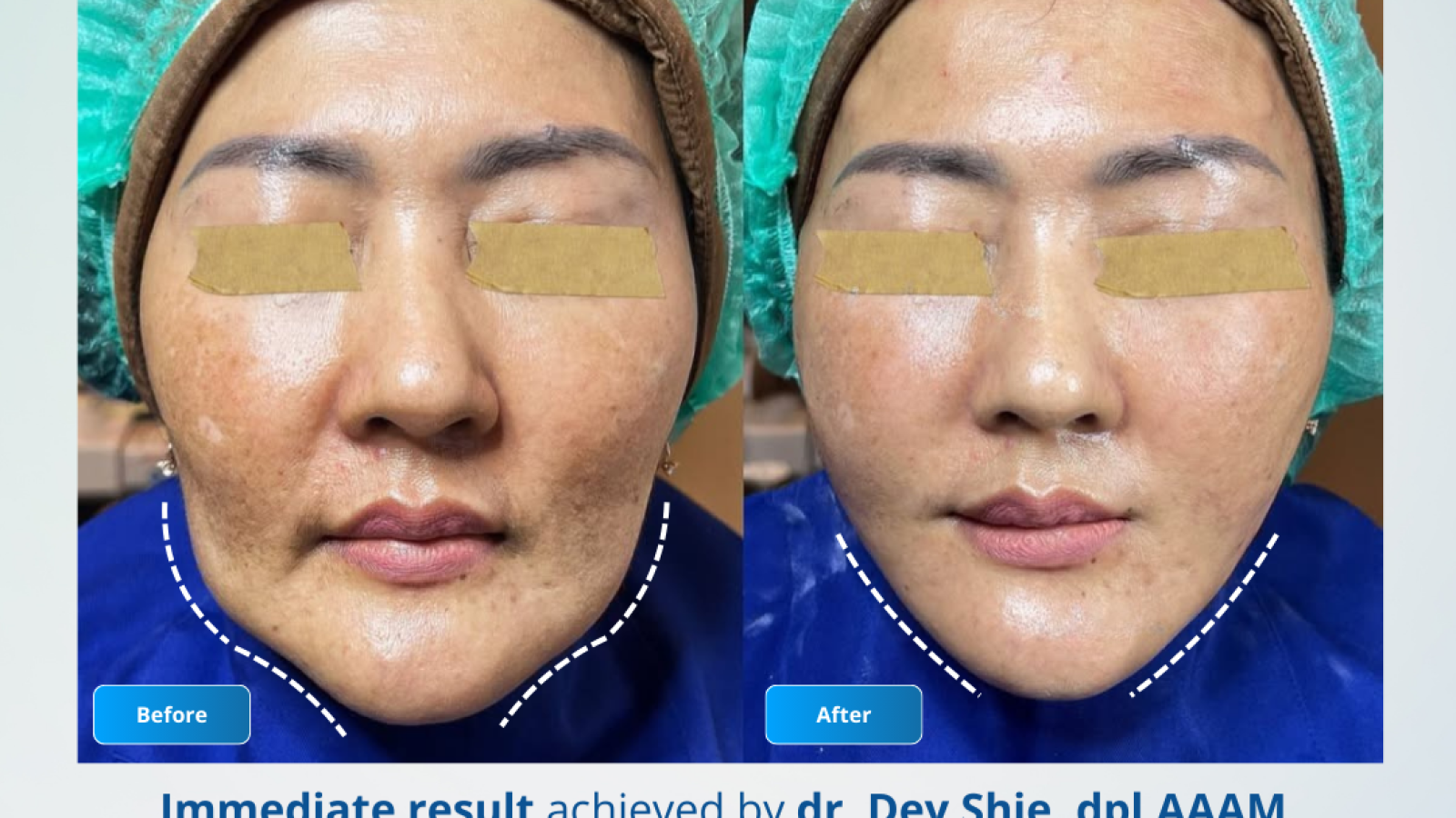 BA dr. Dey Shie, D.AAM