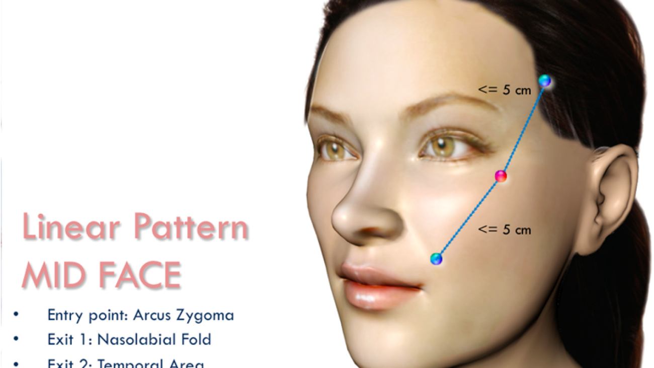 Training Handout Linear Pattern 2