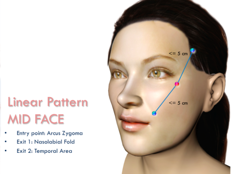 Training Handout Linear Pattern 2
