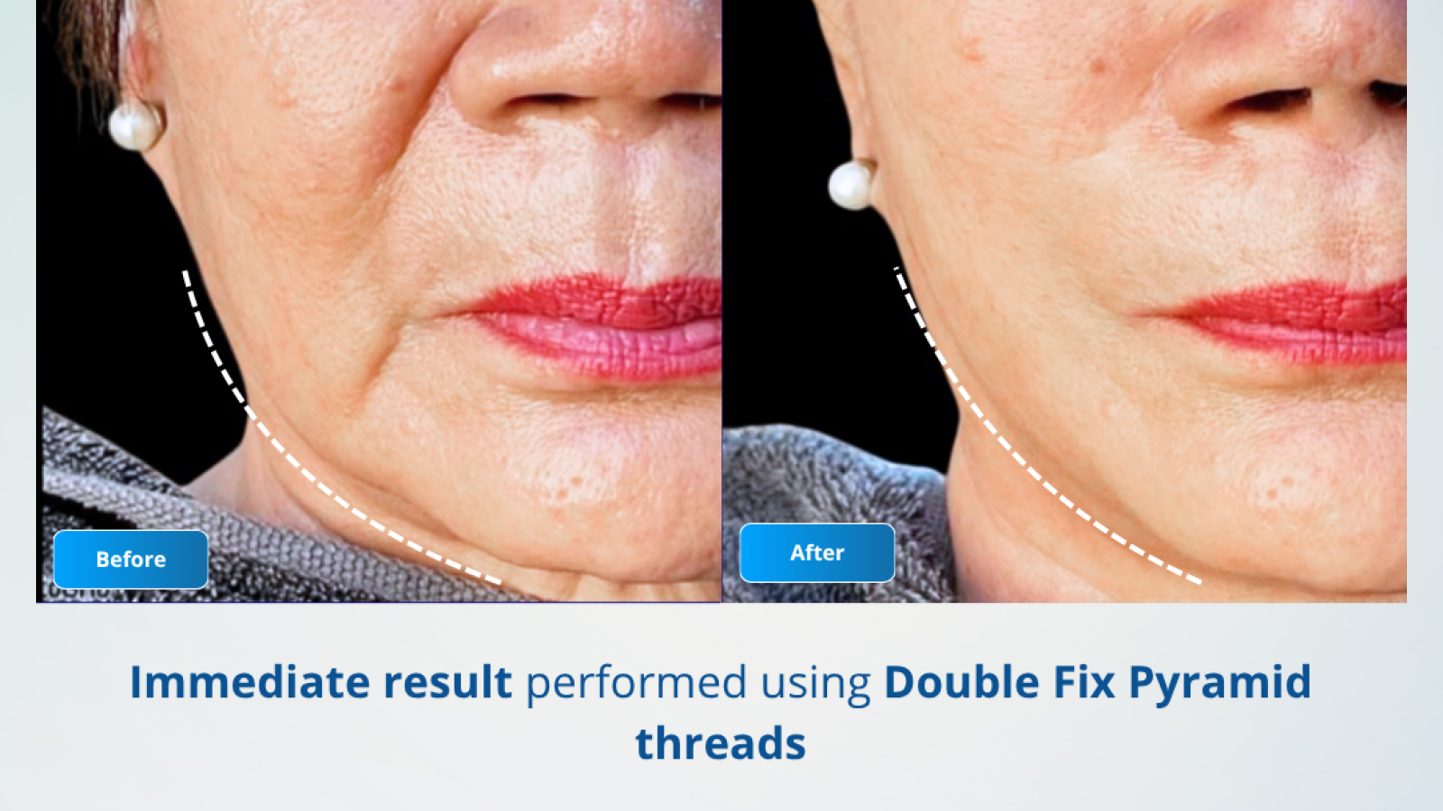 Before After - 4 Desember by dr shinta Novianti M.biomed (AAM)