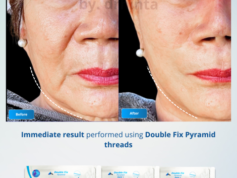 Before After - 4 Desember by dr shinta Novianti M.biomed (AAM)