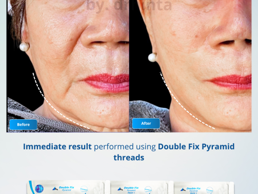 Before After - 4 Desember by dr shinta Novianti M.biomed (AAM)