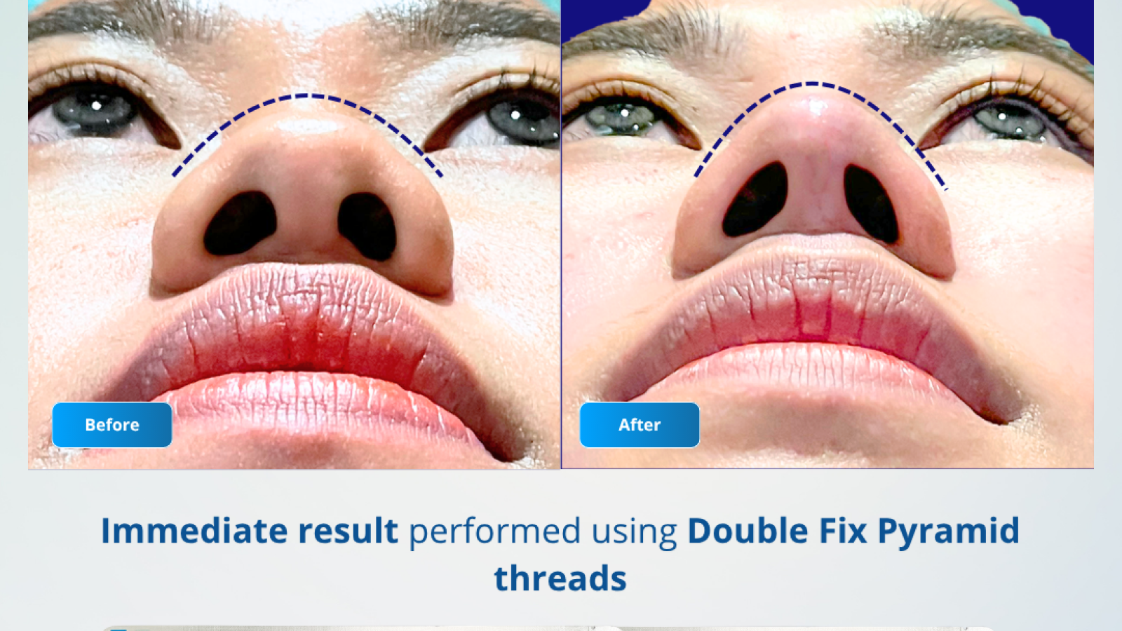 Before After - Train to Trainer 20 November