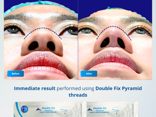 Before After - Train to Trainer 20 November